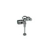 Plumbing Zurn Zurn Flush Valves | Aquavantage Exposed Battery Powered Sensor Flush Valve For 3/4" Urinals (0.5 Gpf)